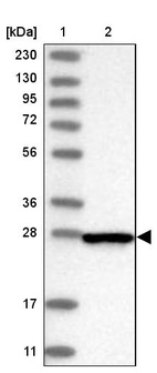 Lane 1: Marker [kDa] 230, 130, 95, 72, 56, 36, 28, 17, 11_br/_Lane 2: Human cell line RT-4