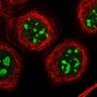 Immunofluorescent staining of human cell line A-431 shows localization to nucleus & nucleoli.