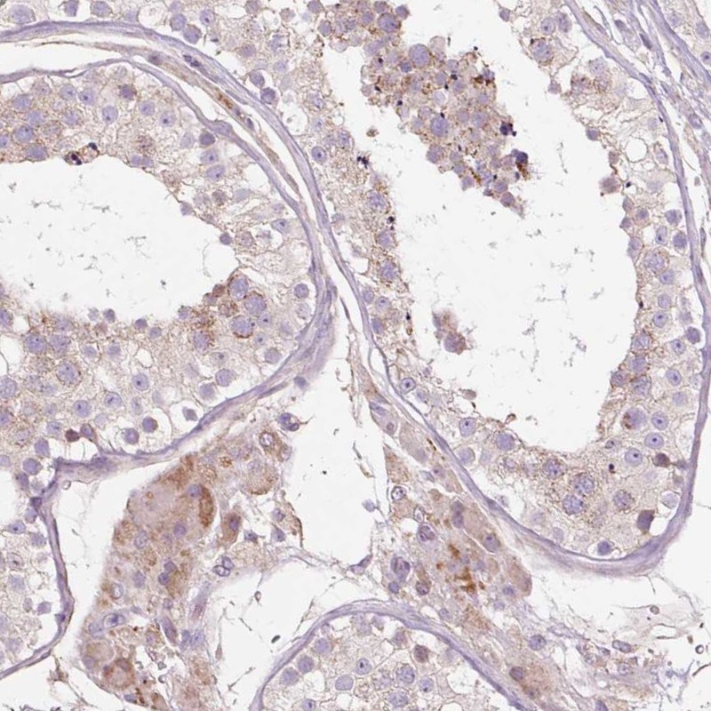 Anti-PDZD2 Antibody