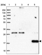 Lane 1: Marker [kDa] 250, 130, 95, 72, 55, 36, 28, 17, 10_br/_Lane 2: Human cell line RT-4_br/_Lane 3: Human cell line U-251MG sp_br/_Lane 4: Human plasma (IgG/HSA depleted)_br/_Lane 5: Human liver tissue