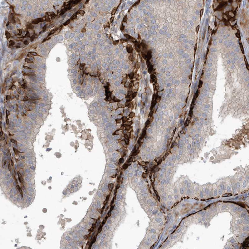 Anti-ARHGEF38 Antibody