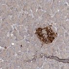 Immunohistochemical staining of human pancreas shows strong cytoplasmic positivity in islets of Langerhans.