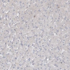 Immunohistochemical staining of human liver shows negative positivity in hepatocytes as expected.