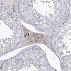 Anti-ZNF622 Antibody