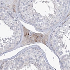 Anti-ZNF622 Antibody