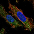 Immunofluorescent staining of human cell line SiHa shows localization to cytosol.