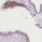 Anti-SLC39A10 Antibody
