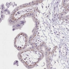 Immunohistochemical staining of human placenta shows moderate membranous positivity in trophoblastic cells.