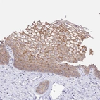 Immunohistochemical staining of human squamous epithelia shows strong membranous positivity in squamous epithelial cells.