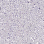 Anti-SLC39A10 Antibody