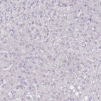 Immunohistochemical staining of human liver shows very no positivity in hepatocytes as expected.