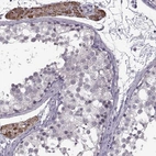 Immunohistochemical staining of human testis shows high expression.