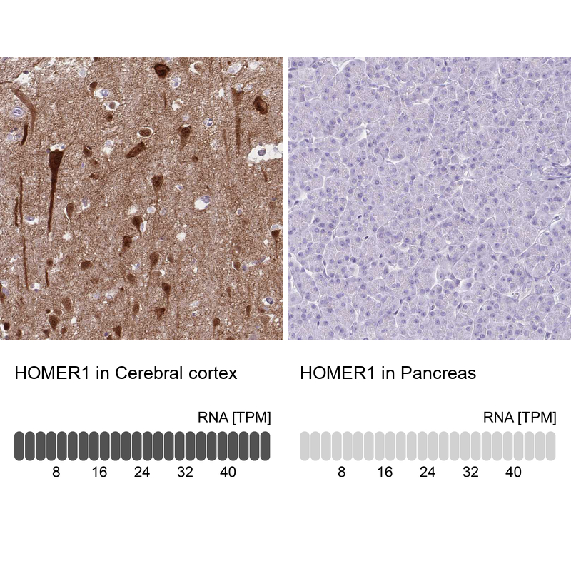 Anti-HOMER1 Antibody