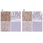 Immunohistochemical staining of human cerebral cortex, colon, heart and pancreas using Anti-HOMER1 antibody HPA036521 (A) shows similar protein distribution across tissues to independent antibody HPA036522 (B).