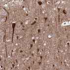 Immunohistochemical staining of human cerebral cortex shows strong cytoplasmic positivity in neurons.
