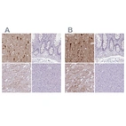 Immunohistochemical staining of human cerebral cortex, colon, heart and pancreas using Anti-HOMER1 antibody HPA036522 (A) shows similar protein distribution across tissues to independent antibody HPA036521 (B).