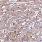 Immunohistochemical staining of human heart muscle shows moderate cytoplasmic positivity in cardiomyocytes.