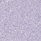 Immunohistochemical staining of human pancreas shows no positivity in exocrine glandular cells as expected.