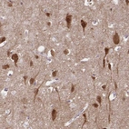 Immunohistochemical staining of human cerebral cortex shows strong cytoplasmic positivity in neurons.
