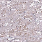 Immunohistochemical staining of human heart muscle shows moderate cytoplasmic positivity in cardiomyocytes.