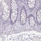 Immunohistochemical staining of human colon shows no positivity in glandular cells as expected.