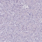 Immunohistochemical staining of human pancreas shows no positivity in exocrine glandular cells as expected.
