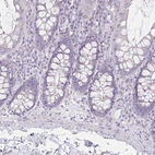 Immunohistochemical staining of human colon shows no positivity in glandular cells as expected.