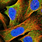 Immunofluorescent staining of human cell line U-2 OS shows localization to cytosol.