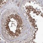 Anti-FAM13B Antibody