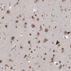 Immunohistochemical staining of human cerebral cortex shows moderate nuclear and cytoplasmic positivity in neurons.