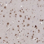 Immunohistochemical staining of human cerebral cortex shows moderate nuclear and cytoplasmic positivity in neurons.