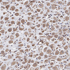 Immunohistochemical staining of human placenta shows moderate cytoplasmic positivity in decidual cells.
