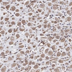 Immunohistochemical staining of human placenta shows moderate cytoplasmic positivity in decidual cells.