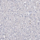 Immunohistochemical staining of human liver shows no positivity in hepatocytes as expected.