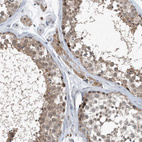 Immunohistochemical staining of human testis shows moderate cytoplasmic positivity in cells in seminiferous ducts.