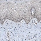 Immunohistochemical staining of human cervix, uterine shows weak cytoplasmic positivity in squamous epithelial cells.