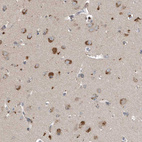 Immunohistochemical staining of human cerebral cortex shows strong granular cytoplasmic positivity in neurons.