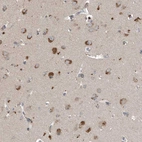 Immunohistochemical staining of human cerebral cortex shows strong granular cytoplasmic positivity in neurons.