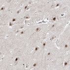 Anti-WAC Antibody