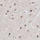Anti-WAC Antibody