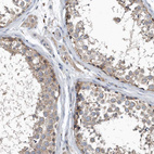 Immunohistochemical staining of human testis shows weak cytoplasmic positivity in cells in seminiferous ducts.