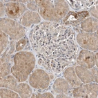 Immunohistochemical staining of human kidney shows weak to moderate cytoplasmic positivity in cells in tubules.