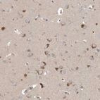 Immunohistochemical staining of human cerebral cortex shows strong granular cytoplasmic positivity in neurons.