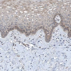 Immunohistochemical staining of human cervix, uterine shows weak cytoplasmic positivity in squamous epithelial cells.
