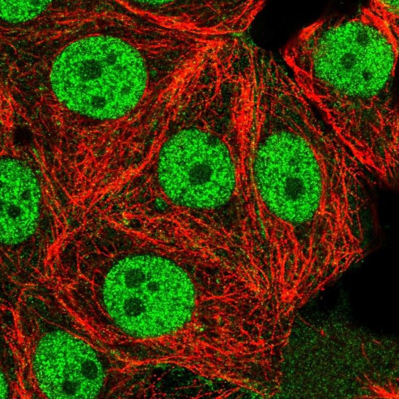 Anti-USF1 Antibody