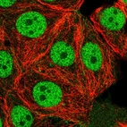 Anti-USF1 Antibody
