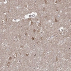 Anti-HARS Antibody