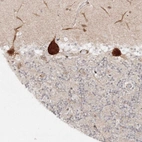 Immunohistochemical staining of human cerebellum shows positivity in Purkinje cells.