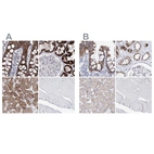 Immunohistochemical staining of human colon, kidney, liver and skeletal muscle using Anti-HIBCH antibody HPA036541 (A) shows similar protein distribution across tissues to independent antibody HPA036540 (B).
