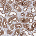 Immunohistochemical staining of human kidney shows positivity in cells in tubules.
